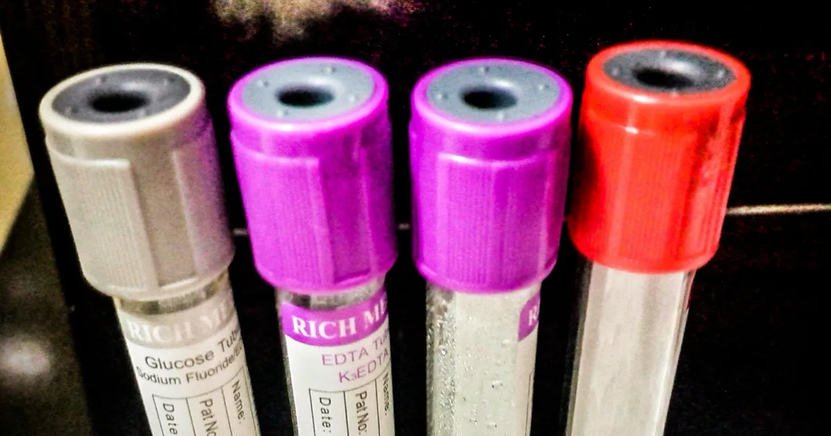 Tubes de prélèvement sanguin dans un portoir, en laboratoire d'analyses